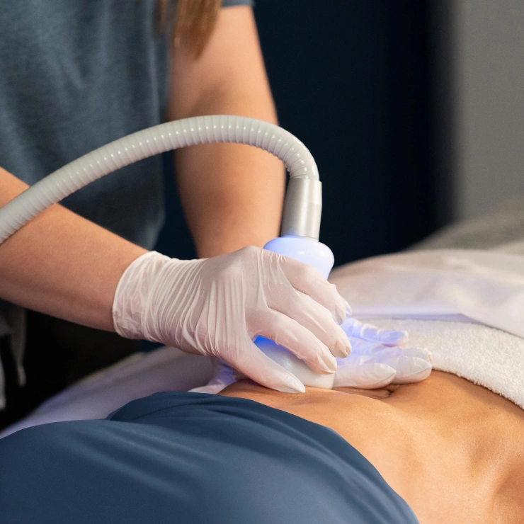 Person receiving Neveskin™ Tone on their abdomen